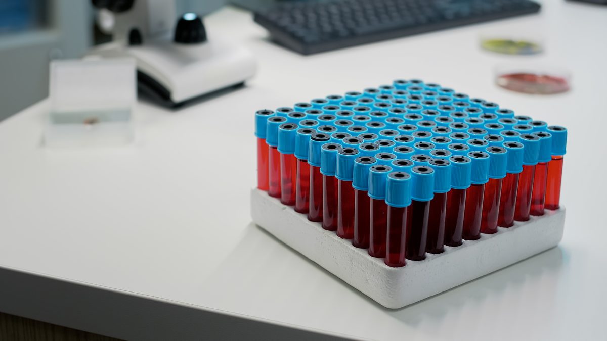 Portoir de tubes de prélèvement sanguin dans un laboratoire d'analyses