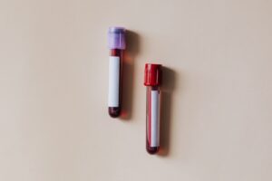 Ferritine élevée : ce que l&rsquo;alimentation peut (et ne peut pas) faire