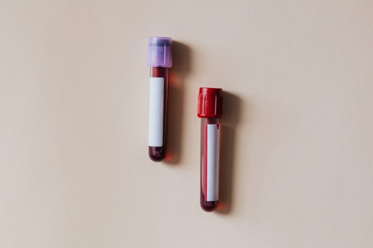 Blood sample tubes for a ferritin test